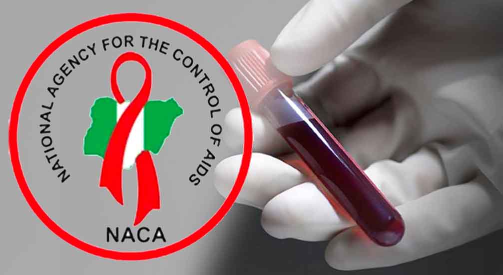 About 29 Persons With HIV Died During Abalaka’s Treatment - NACA, DG